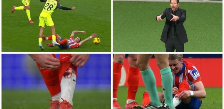  硬漢！加拉格爾拼搶中小腿受傷鮮血直流，他未接受治療堅(jiān)持比賽