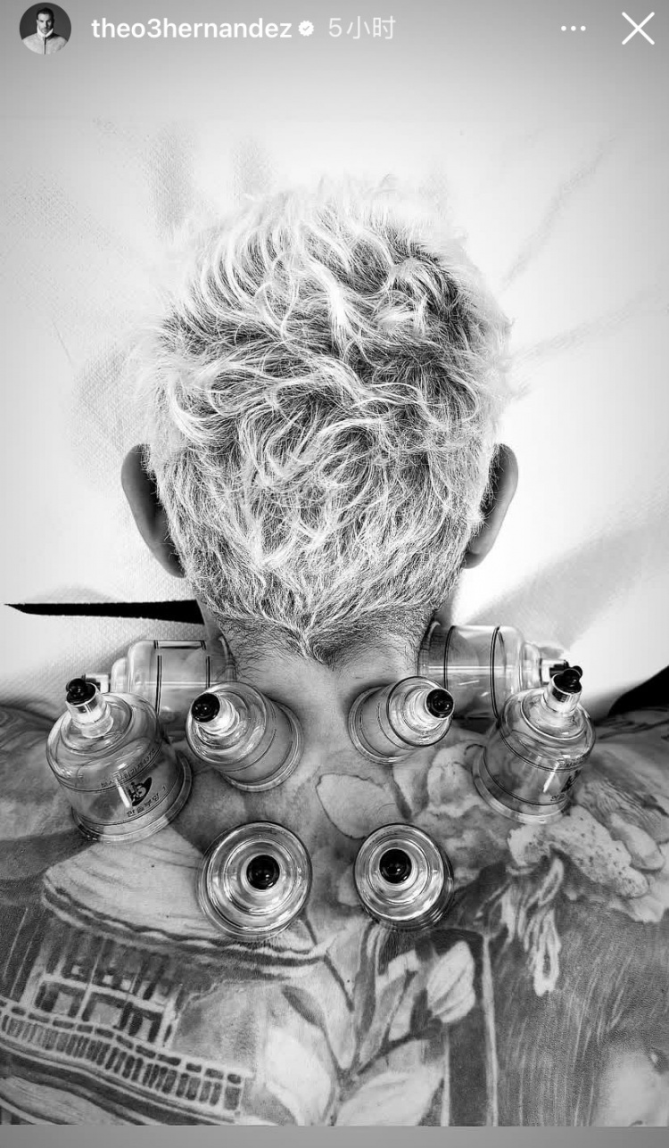  神秘東方力量加持？特奧社媒曬照，自己正在接受拔罐治療