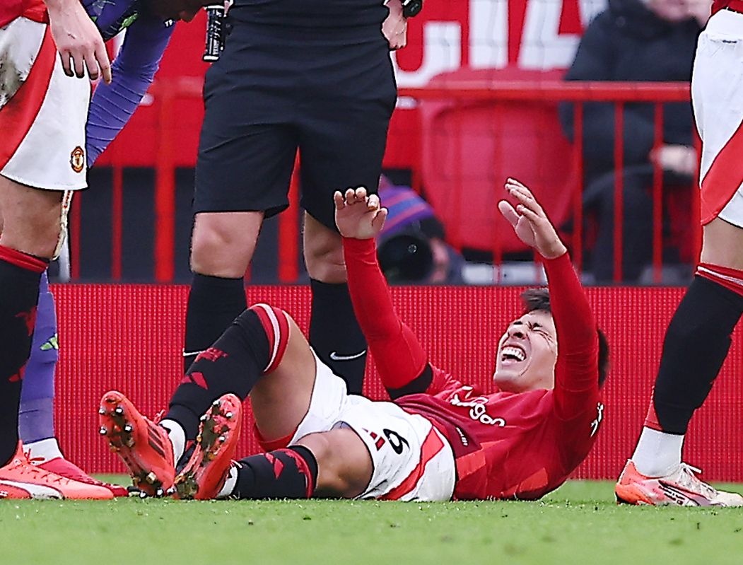  曼晚：利馬預計賽季報銷，盧克肖&多古&德里赫特可能踢左中衛(wèi)